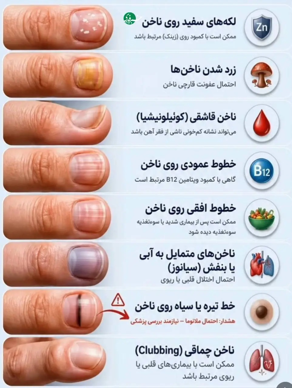 هر لکه و خط روی ناخن یک هشدار است؛ معنی آن‌ها را بدانید