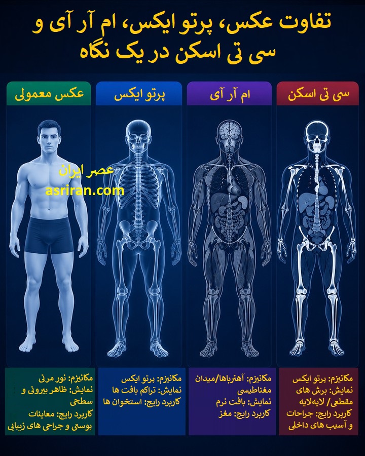 اینفوگرافیک مقایسه عکس معمولی (Photo)، پرتو ایکس (X-Ray)، ام آر آی (MRI) و سی تی اسکن (CT Scan)