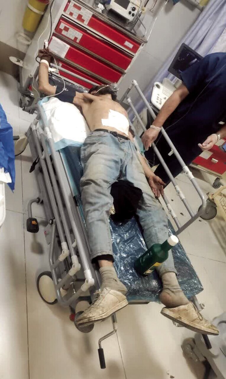 مصدوم حادثه