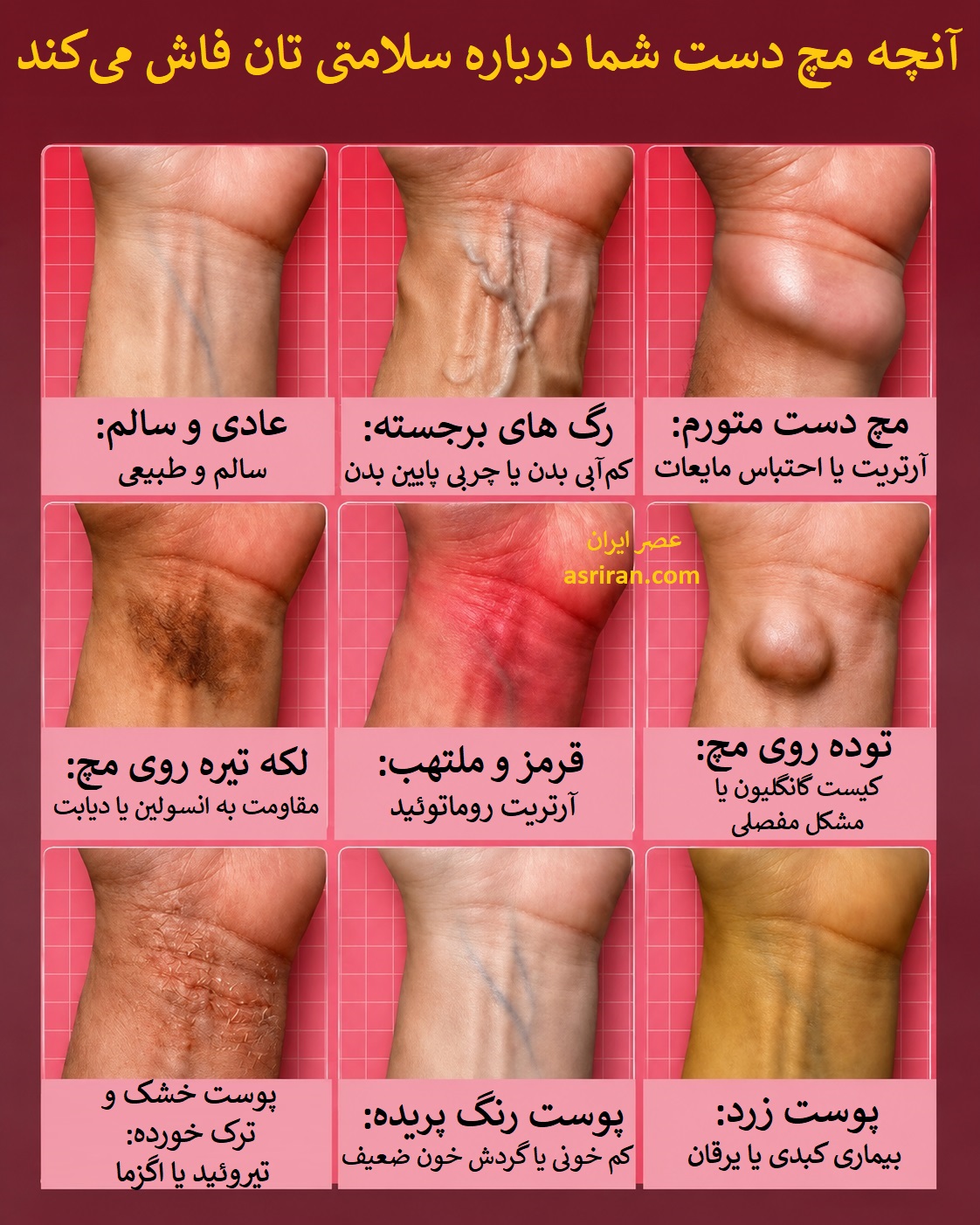 اینفوگرافیک رازهایی که مچ دست درباره سلامت شما فاش می کند