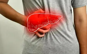 کبد چرب؛ شایع‌ترین بیماری کبدی جهان