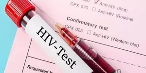 آخرین آمار مرکز تحقیقات ایدز ایران از مبتلایان به HIV