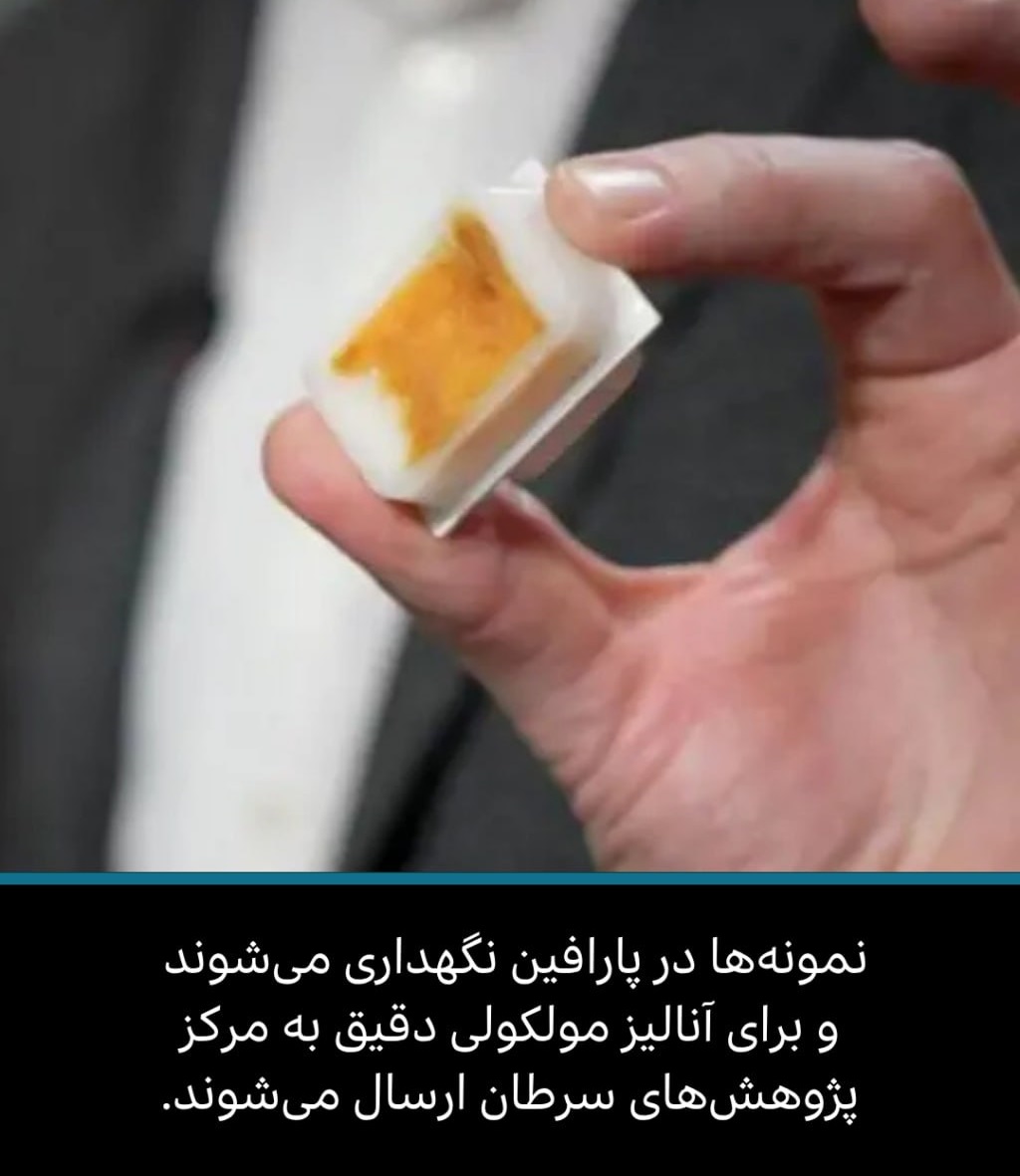 نمونه‌ها برای ماندگاری در پارافین نگهداری می‌شوند