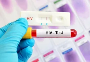 آغاز پویش «من هم تست HIV می‌دهم» از امروز تا ۲۰ آذرماه