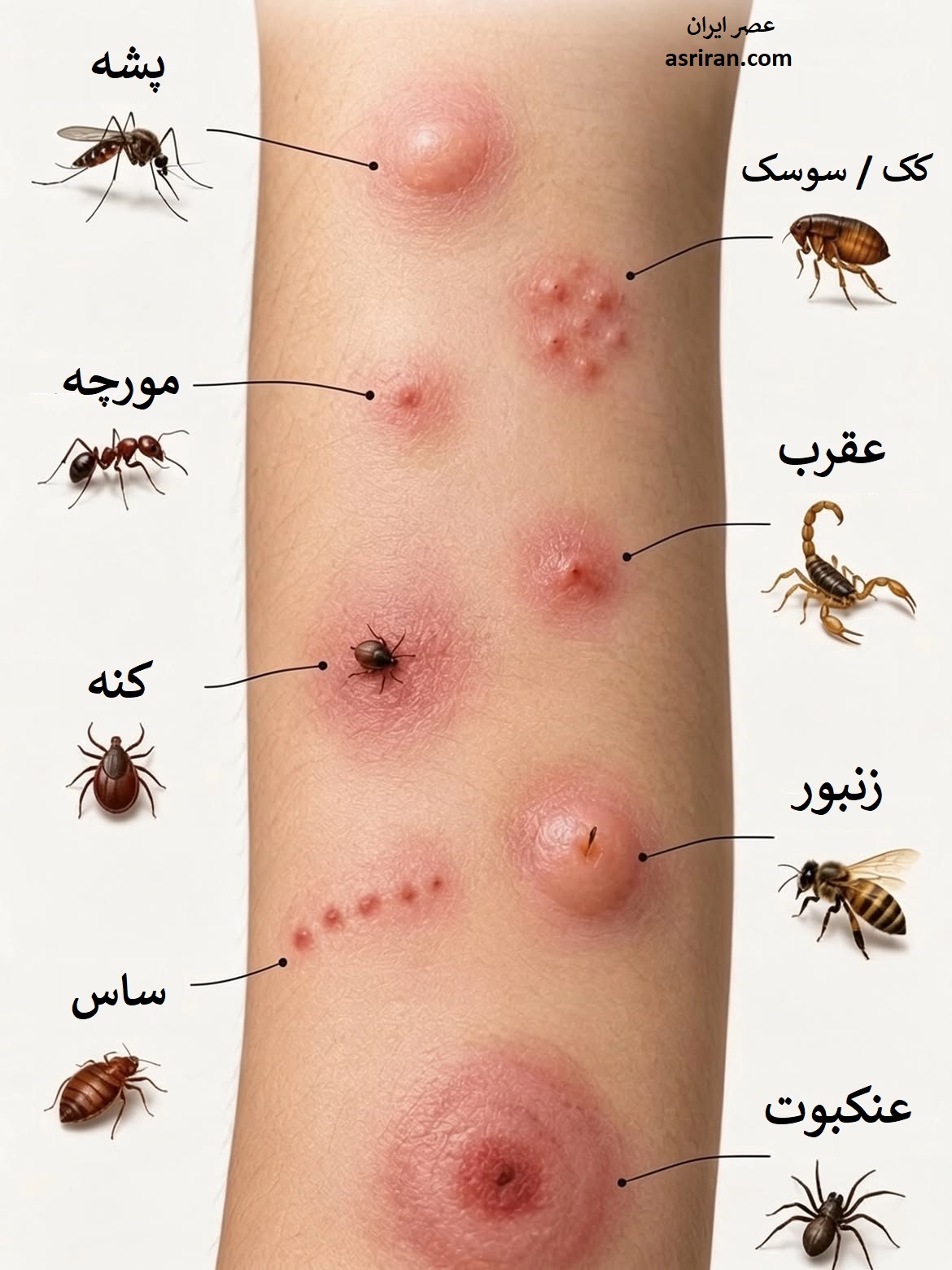 اینفوگرافیک راهنمای سریع و کاربردی تشخیص رایج ترین گزیدگی های حشرات بر اساس شکل ظاهری آن ها اینفوگرافیک راهنمای سریع و کاربردی تشخیص رایج ترین گزیدگی های حشرات بر اساس شکل ظاهری آن ها