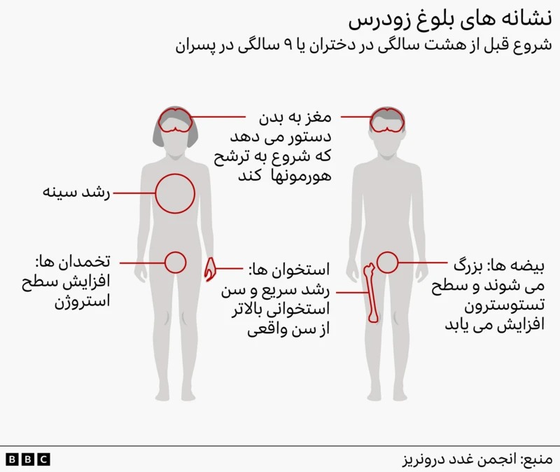 نشانه های بلوغ زودرس