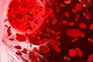 تشخیص علت فقر آهن را به تأخیر نیندازید