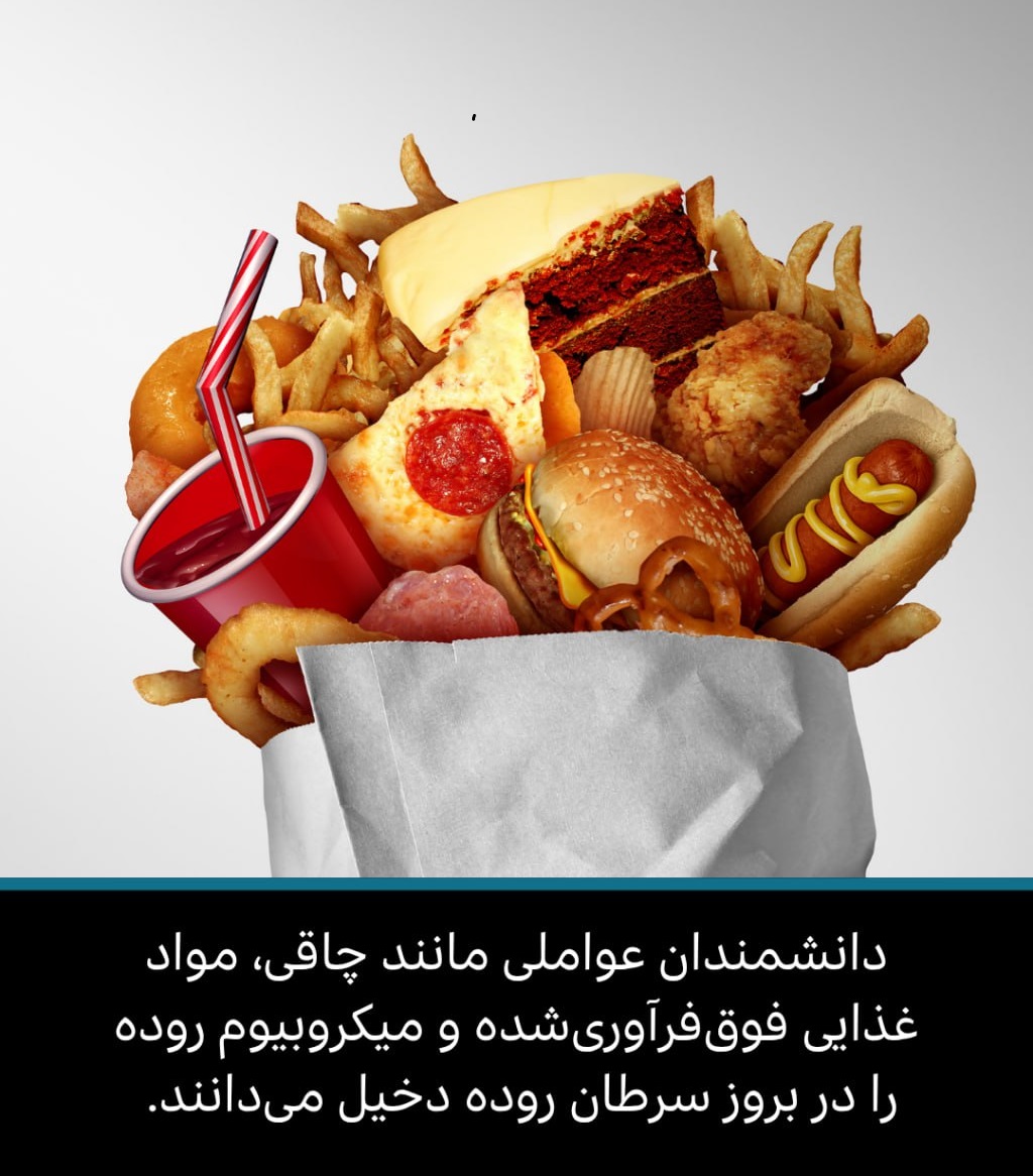 در جست‌وجوی سرنخ‌هایی درباره افزایش بروز سرطان روده در میان جوانان